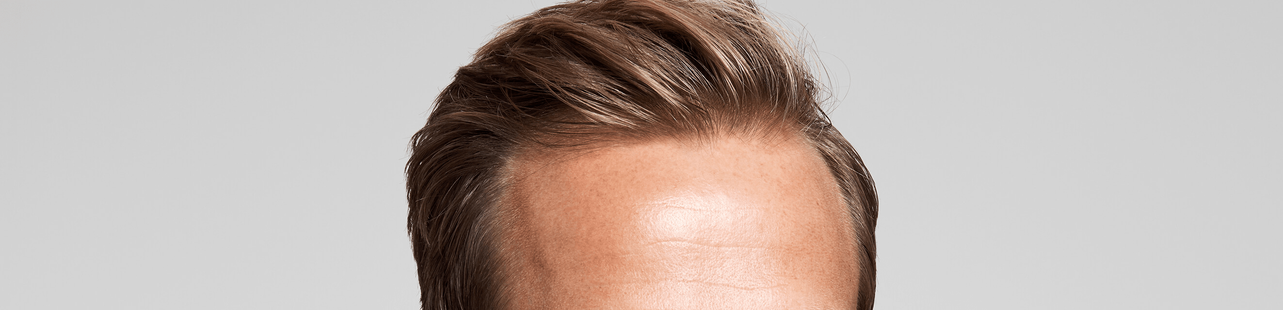 A persons hairline