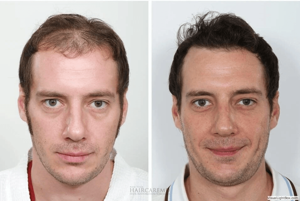 Before and after of person